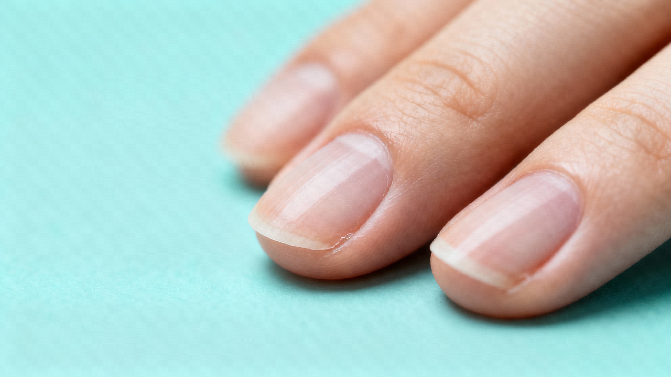 Featured image for Saying Farewell to Periungual Warts: OTC Treatment Options Uncovered